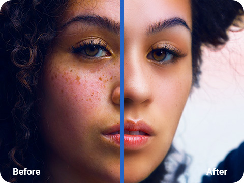 Face enhanced picture of female with freckles before and after